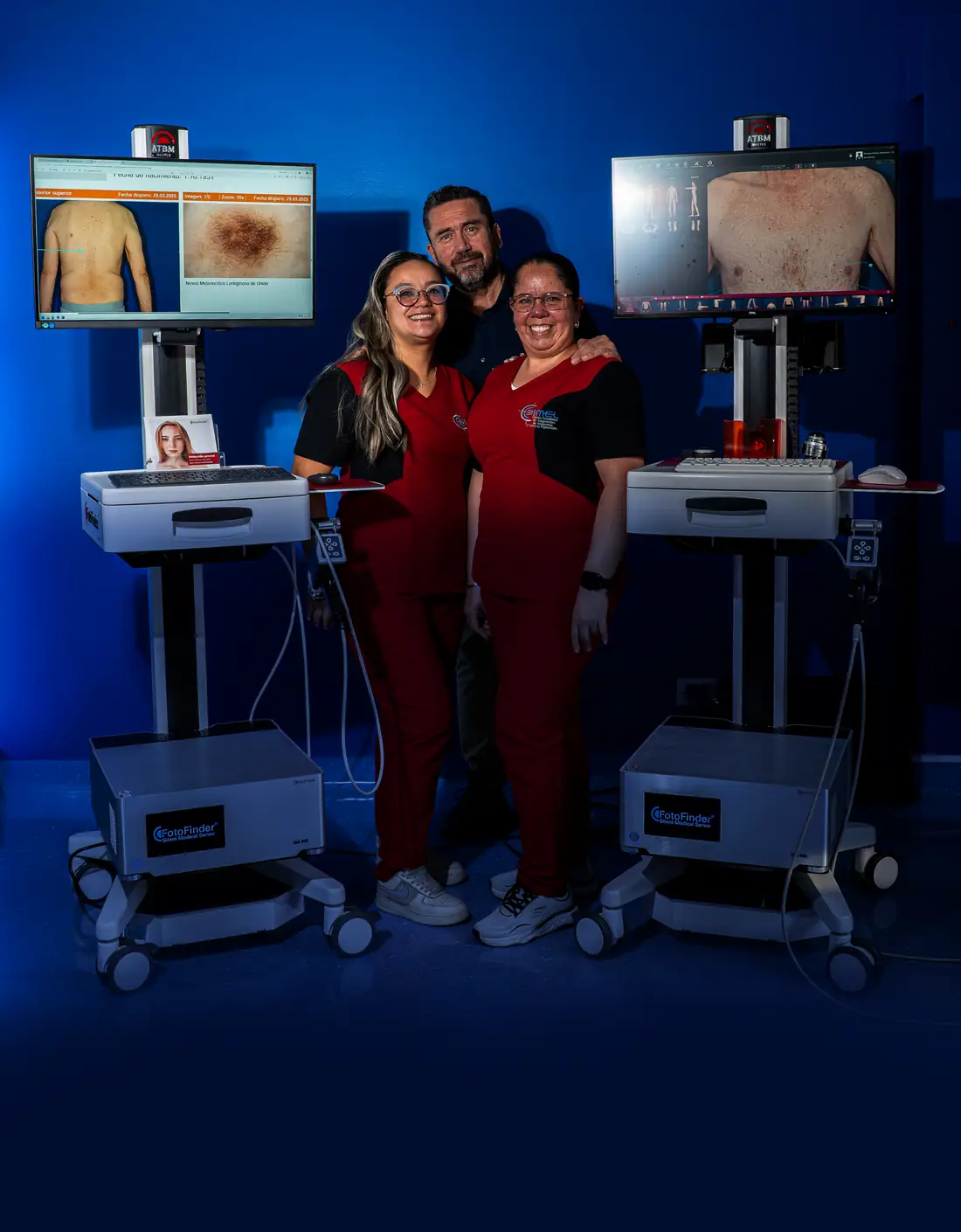 Equipo de CCDIMEL junto a los equipos de dermatoscopia digital